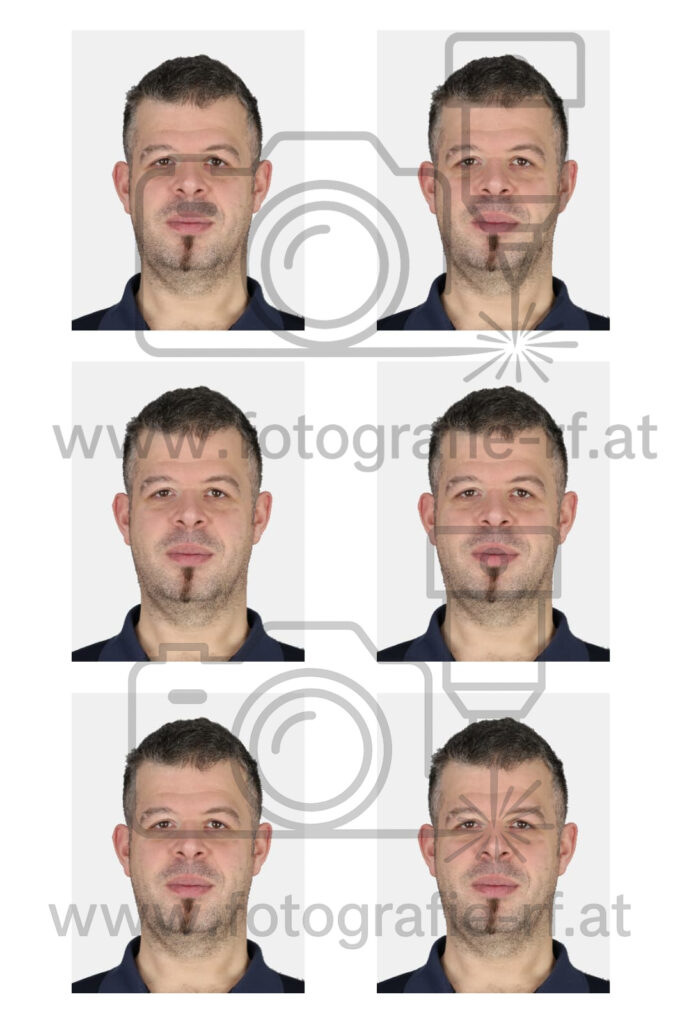 Collage of six facial portraits showing the same man from various angles against a plain background.